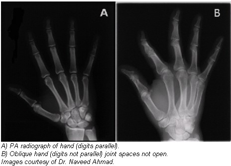 Hand X-rays: The Superpower Supertool - CIA Medical