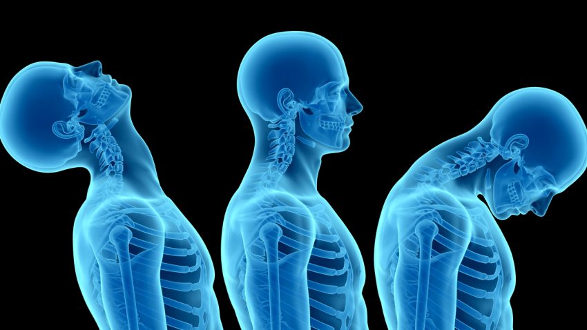 Anatomy of human body, showing neck injuries like whiplash effect