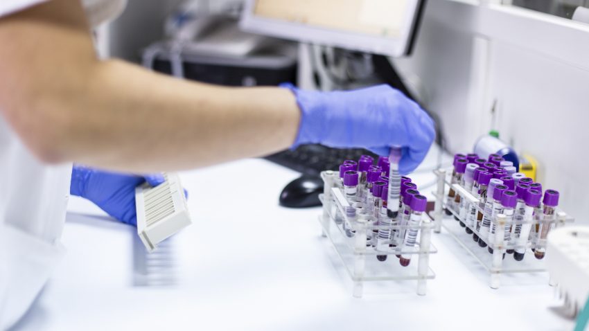 Blood tubes at the microbiology laboratory