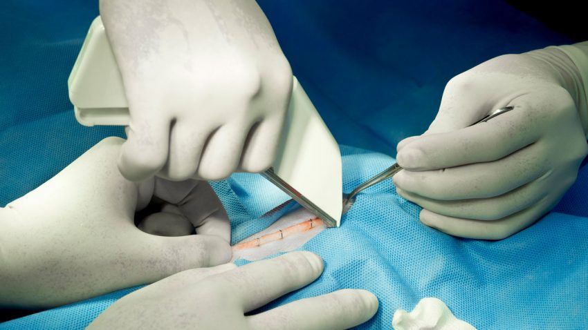 Surgical staples placed to close a wound by a veterinarian