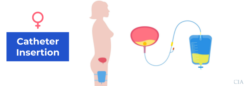how to insert a catheter female patient