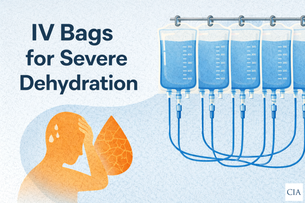 How Many IV Bags for Severe Dehydration