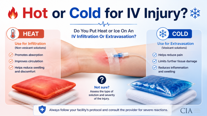 Heat or Cold Ice On An IV Infiltration Or Extravasation Injury